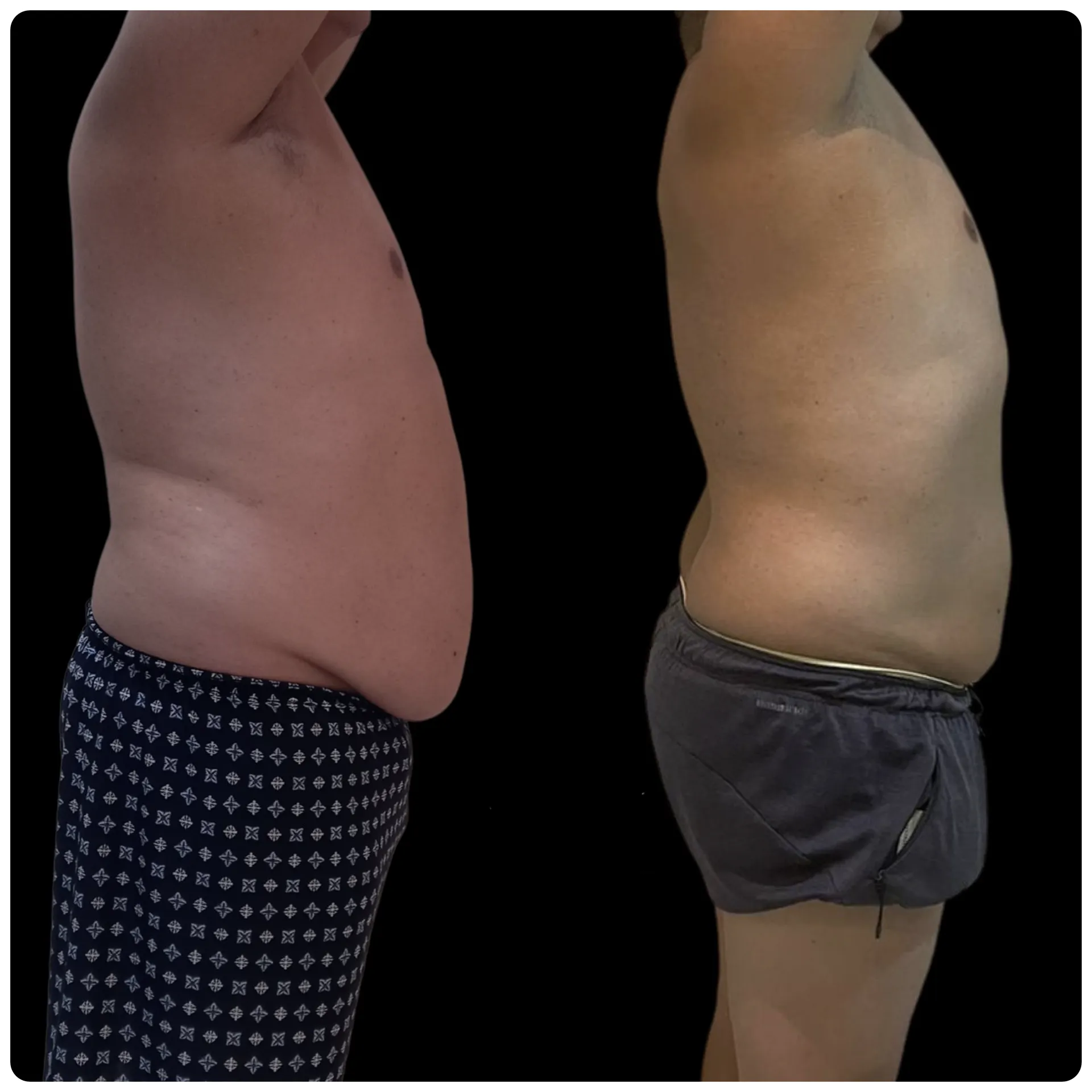 Resultado comprovado